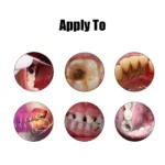 Tooth Pain Relief Treatment Spray Toothache Cure Teeth Decay Remover Killer Periodontitis Cleaner Angelica Dahurica Medicine - Image 5