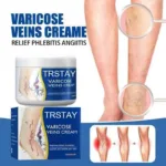 Leg Vein Repair Cream Varicose Massage Earthworm Leg Pain Swelling Huoluomaikang Antibacterial Topical Body Care Cream