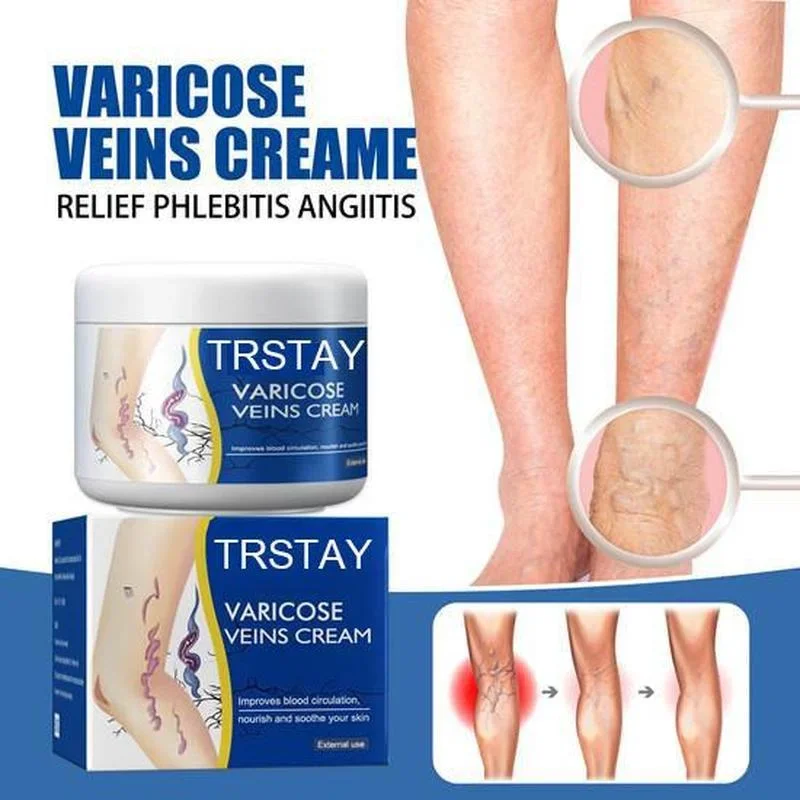 S049bb775696a4622bbc6a24b4f650dd6o.webp Leg Vein Repair Cream Varicose Massage Earthworm Leg Pain Swelling Huoluomaikang Antibacterial Topical Body Care Cream - Image 1