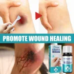 Liquid Dressing Transparent Waterproof Bandage Wound Hemostatic Disinfecting Adhesive Liquid Band-Aid Wound Healing Gel 10ml - Image 6