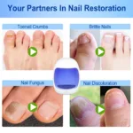 Nail Fungus Laser Treatment Feet Onychomycosis Repair Toenail Nails Device Fingernail Health Care - Image 3