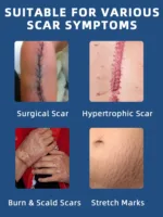 Scar Removal Cream Remove Keloid Surgical Burn Scald Caesarean Section Scars - Image 4