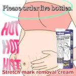 Gentle Skin Care Improves Elasticity Effective After Pregnancy Stretch Marks Removal Powerful Maternity Cream Nourishes Skin - Image 4
