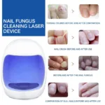 Nail Fungus Laser Treatment Feet Onychomycosis Repair Toenail Nails Device Fingernail Health Care - Image 2