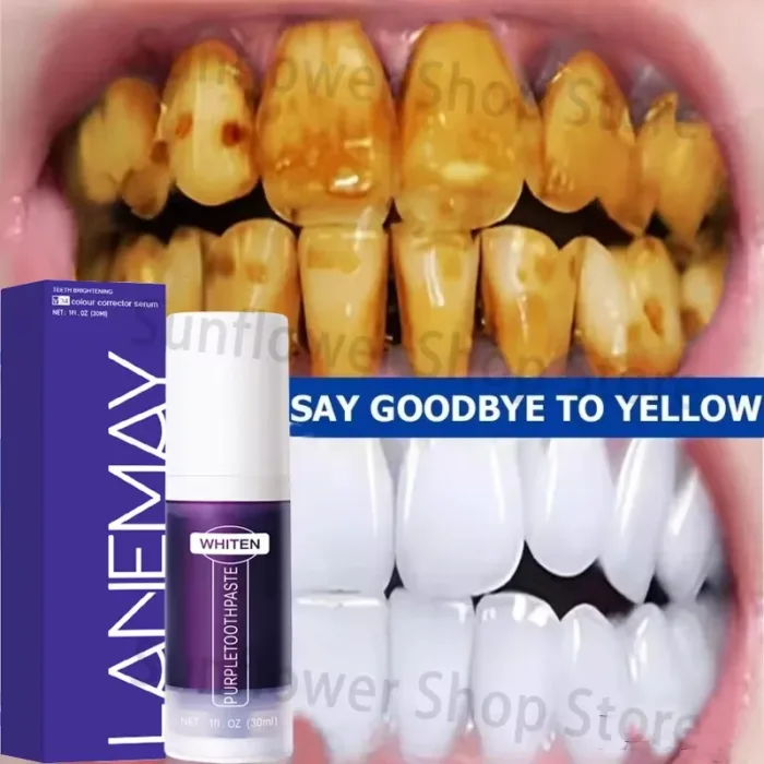 V34 Teeth Whitening Toothpaste Remove Plaque Coffee Stains Cleaning Oral Hygiene Bleaching Dental Tools Fresh Breath Tooth Care - Image 6