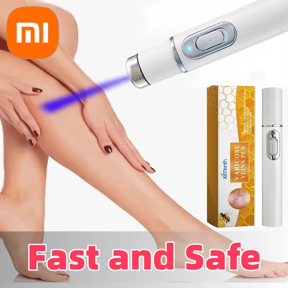 S71e5f7ce00784ed9a783a94e16958ad8U.webp Xiaomi Therapy Leg Repair Pen Improving Blood Circulation Varicose Veins Relieves Leg Bulge Discomfort Pen Skin Care Product New - Image 1
