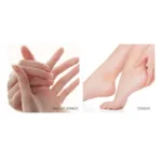 Hand Ringworm Beriberi Fungus Spray Hand and Foot Skin Care Anti Itch Spray 20ml Itching Disinfect Personal Health Care - Image 6