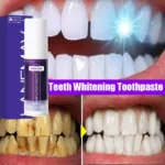 V34 Teeth Whitening Toothpaste Remove Plaque Coffee Stains Cleaning Oral Hygiene Bleaching Dental Tools Fresh Breath Tooth Care - Image 2