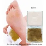 Korea Kinoki Cleansing Detox Leg Healthy Herbal Pads Ubat Feet Care Foot Spa Dropshipping Foot Care Dispel Dampness Sleep Well - Image 5