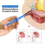 5pcs Prostatitis Medicine Treatment Gel Urological Prostatic Cure Prostatitis Herbal Antibacterial Plaster Health Care - Image 3