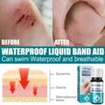 Liquid Dressing Transparent Waterproof Bandage Wound Hemostatic Disinfecting Adhesive Liquid Band-Aid Wound Healing Gel 10ml - Image 5