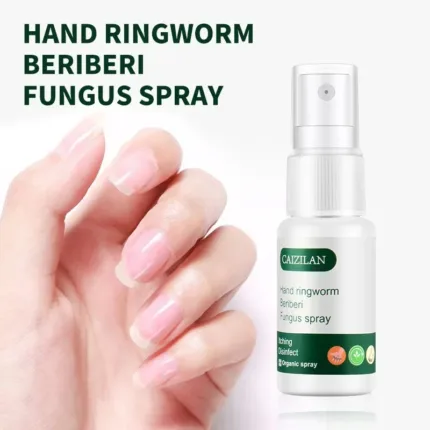 Hand Ringworm Beriberi Fungus Spray Hand and Foot Skin Care Anti Itch Spray 20ml Itching Disinfect Personal Health Care
