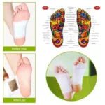 Korea Kinoki Cleansing Detox Leg Healthy Herbal Pads Ubat Feet Care Foot Spa Dropshipping Foot Care Dispel Dampness Sleep Well - Image 4