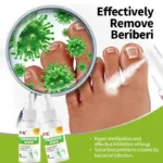 Foot Odor Tinea Pedis Treatment Spray Remover Feet Sweat Beriberi Athlete Foot Peeling Anti Fungal Itch Inhibits Fungus Medicine - Image 3