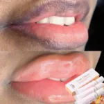 Exfoliating Lip Scrub Exfoliates Dark Lips Lightens Dull Pink Propolis Moisturizing Lip Balm Brightens Resists Crack Moisturizes