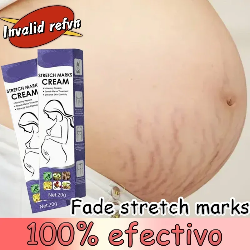 Sb918c77a32b3494b92fe32915e1712c5E.webp Gentle Skin Care Improves Elasticity Effective After Pregnancy Stretch Marks Removal Powerful Maternity Cream Nourishes Skin - Image 1