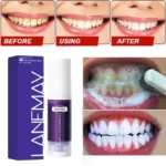 V34 Teeth Whitening Toothpaste Remove Plaque Coffee Stains Cleaning Oral Hygiene Bleaching Dental Tools Fresh Breath Tooth Care - Image 5