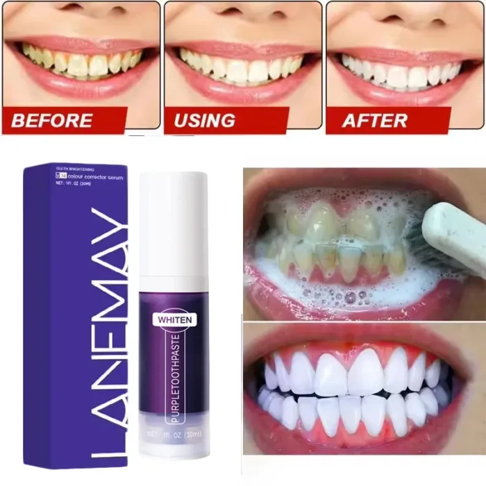 V34 Teeth Whitening Toothpaste Remove Plaque Coffee Stains Cleaning Oral Hygiene Bleaching Dental Tools Fresh Breath Tooth Care - Image 5