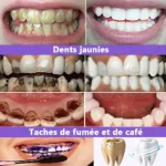 V34 Teeth Whitening Toothpaste Remove Plaque Coffee Stains Cleaning Oral Hygiene Bleaching Dental Tools Fresh Breath Tooth Care - Image 3