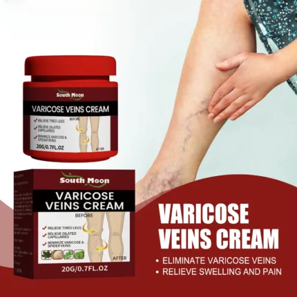 Vein Cream Leg Blood Vessel Bulge Glue Calf Edema Earthworm Leg Pain Relief Varicose Vein Cream Potent Personal Health Care