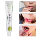 Mouth Ulcer Relief Gel Natural Herbal Oral Hygiene Antibacterial Cream Severe Pain Irritation Bad Breath Inflammation Creatina - Image 3
