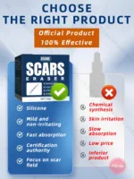 Scar Removal Cream Remove Keloid Surgical Burn Scald Caesarean Section Scars - Image 6