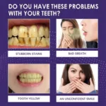 V34 Teeth Whitening Toothpaste Remove Plaque Coffee Stains Cleaning Oral Hygiene Bleaching Dental Tools Fresh Breath Tooth Care - Image 4