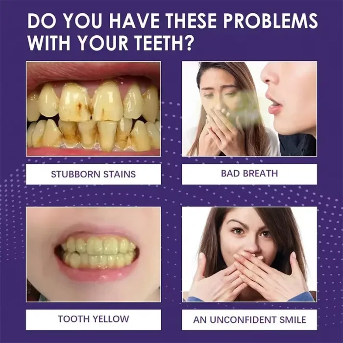 V34 Teeth Whitening Toothpaste Remove Plaque Coffee Stains Cleaning Oral Hygiene Bleaching Dental Tools Fresh Breath Tooth Care - Image 4