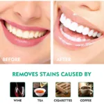 V34 Teeth Whitening Toothpaste 5D Tooth Whitener Strips Oral Hygiene Cleaning Dental Bleaching Tools Fresh Breath Dentistry Care - Image 6