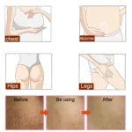 Effective  Remove Pregnancy Scars Acne Cream Stretch Mark Treatment Maternity Repair Anti-Aging Anti-Winkle Firming Body Cream - Image 5
