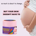 Effective  Remove Pregnancy Scars Acne Cream Stretch Mark Treatment Maternity Repair Anti-Aging Anti-Winkle Firming Body Cream