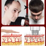Hair essential oil massage comb, applicator + essence, accelerate hair growth, thick hair in 5 days - Image 4
