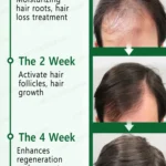 Hair essential oil massage comb, applicator + essence, accelerate hair growth, thick hair in 5 days - Image 6