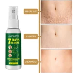 7 Days Stretch Marks Spray For Pregnancy Remove Postpartum Obesity Women Scar Without Side Effect Butt Firm Lift Skin Body Cream - Image 3