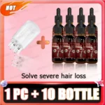 Hair essential oil massage comb, applicator + essence, accelerate hair growth, thick hair in 5 days - Image 9