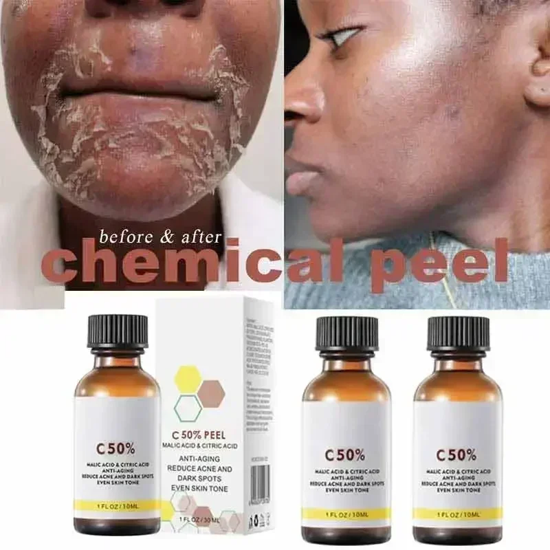 S6d8d43f066ba41a49042db7f1c5e58adD.webp Face Care Exfoliating Radiant Skin Fade Dark Spots & Pigmentation for Even Brighter Skin Remove Spots Arm Knee Legs Melanin - Image 1