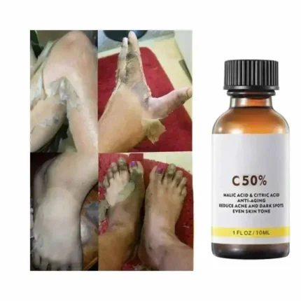 Face Care Exfoliating Radiant Skin Fade Dark Spots & Pigmentation for Even Brighter Skin Remove Spots Arm Knee Legs Melanin - Image 6