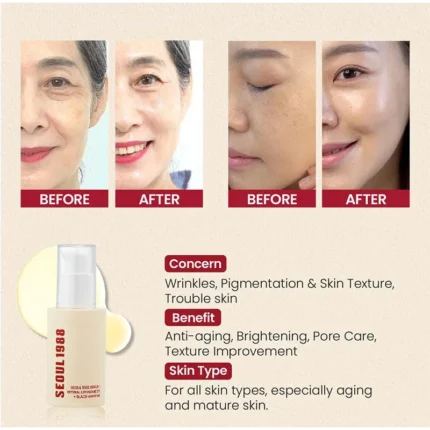 Korean 1988 Retinol Face Care Serum,Black Ginseng Niacinamide Vitamin C Moisturizing Firming Ampoule,Anti Aging Wrinkle Skincare - Image 30